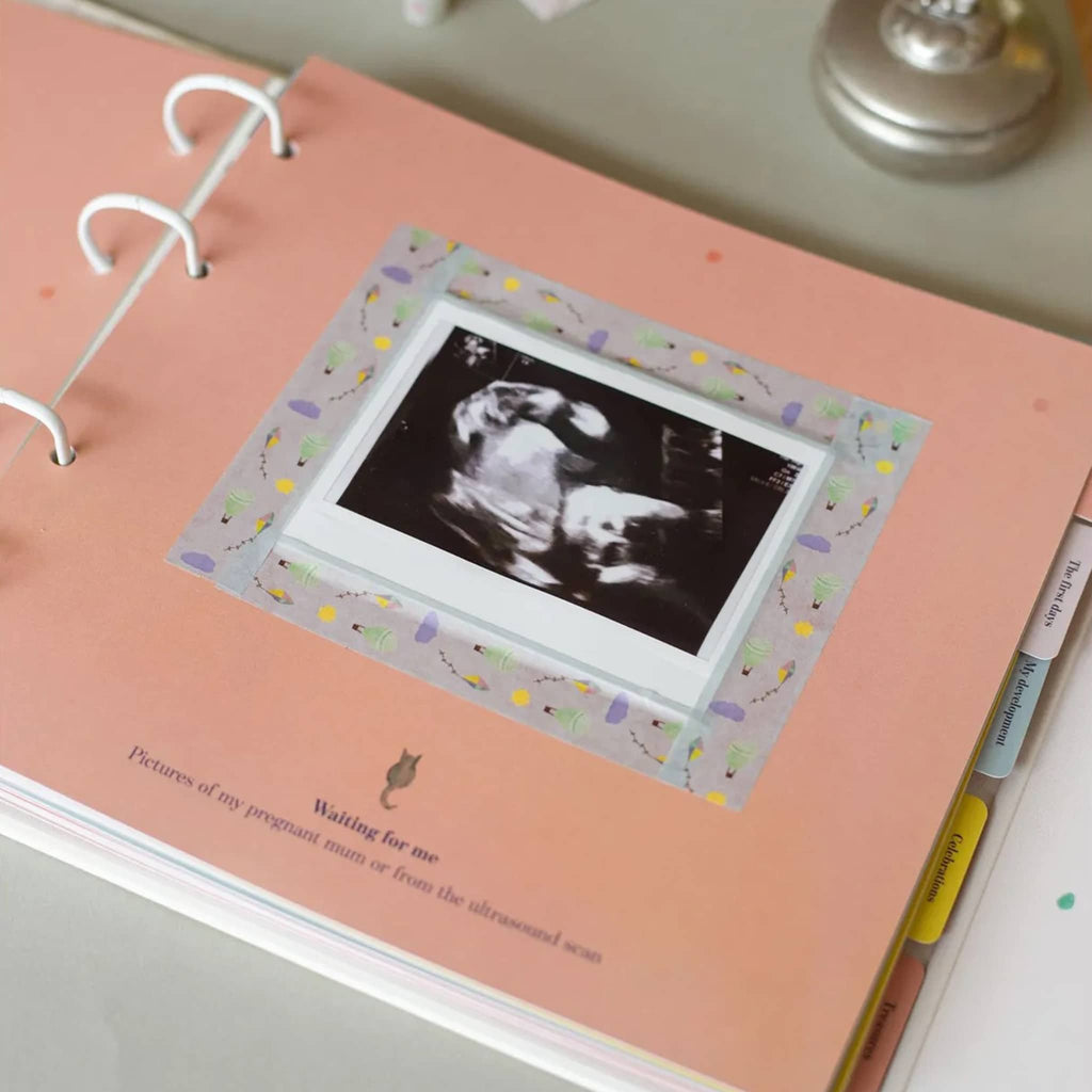 Pink album page with an ultrasound photo on a light gray surface.